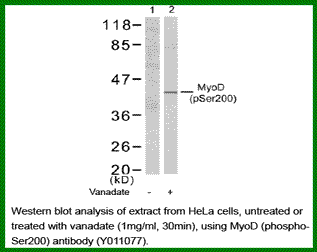 Anti-MyoD (Phospho-Ser200)