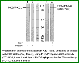 Anti-PKD/PKC&micro; (Phospho-Ser738)