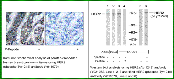 Anti-HER2 (Phospho-Tyr1248)