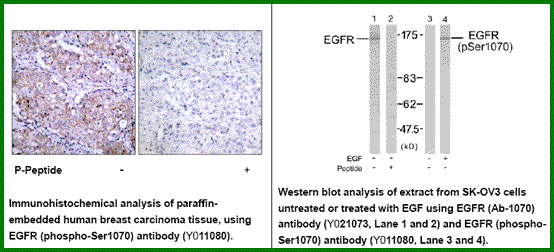 Anti-EGFR (Phospho-Ser1070)