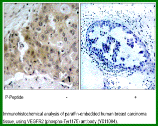 Anti-VEGFR2 (Phospho-Tyr1175)