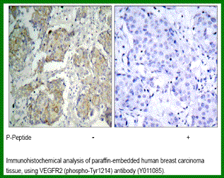 Anti-VEGFR2 (Phospho-Tyr1214)