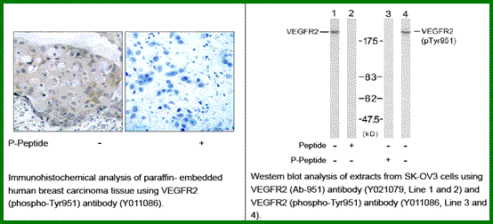 Anti-VEGFR2 (Phospho-Tyr951)