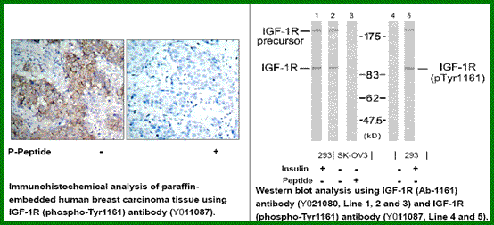 Anti-IGF-1R (Phospho-Tyr1161)