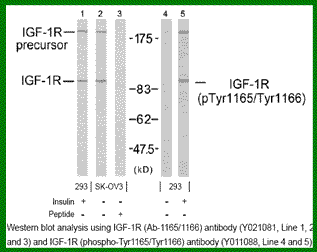 Anti-IGF-1R (Phospho-Tyr1165/Tyr1166)