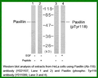 Anti-Paxillin (Phospho-Tyr118)