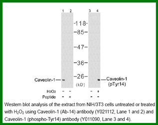 Anti-Caveolin-1 (Phospho-Tyr14)