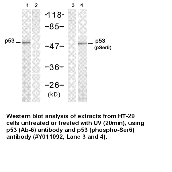 Anti-p53 (Phospho-Ser6)