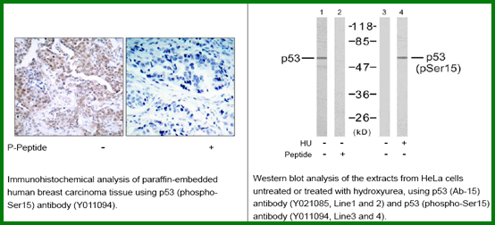 Anti-p53 (Phospho-Ser15)