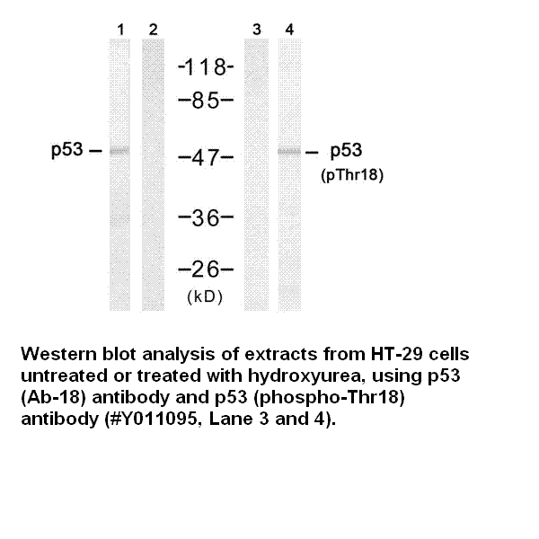 Anti-p53 (Phospho-Thr18)
