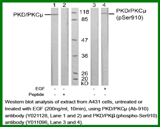 Anti-PKD/PKC&micro; (Phospho-Ser910)