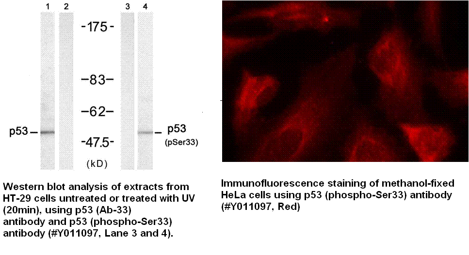 Anti-p53 (Phospho-Ser33)