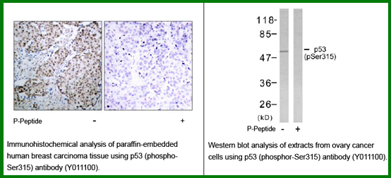 Anti-p53 (Phospho-Ser315)