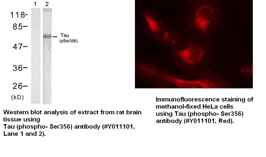 Anti-Tau (Phospho-Ser356)