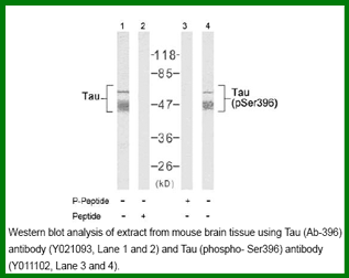 Anti-Tau (Phospho-Ser396)