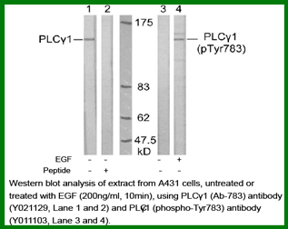 Anti-PLC&gamma;1 (Phospho-Tyr783)