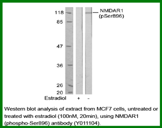 Anti-NMDAR1 (Phospho-Ser896)