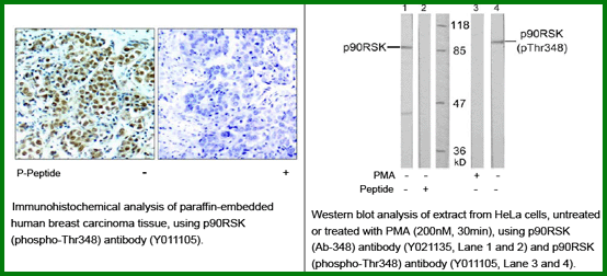 Anti-p90RSK (Phospho-Thr348)