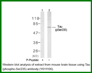 Anti-Tau (Phospho-Ser235)