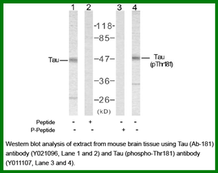 Anti-Tau (Phospho-Thr181)