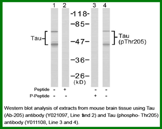 Anti-Tau (Phospho-Thr205)