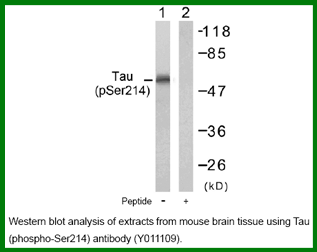 Anti-Tau (Phospho-Ser214)