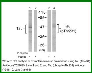Anti-Tau (Phospho-Thr231)