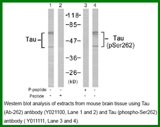 Anti-Tau (Phospho-Ser262)