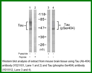 Anti-Tau (Phospho-Ser404)