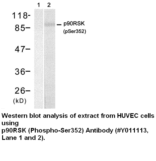 Anti-p90RSK (Phospho-Ser352)