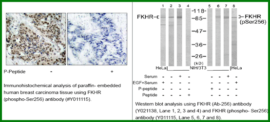 Anti-FKHR (Phospho-Ser256)