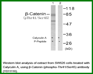 Anti-&beta;-Catenin (Phospho-Thr41/Ser45)