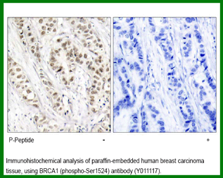 Anti-BRCA1 (Phospho-Ser1524)