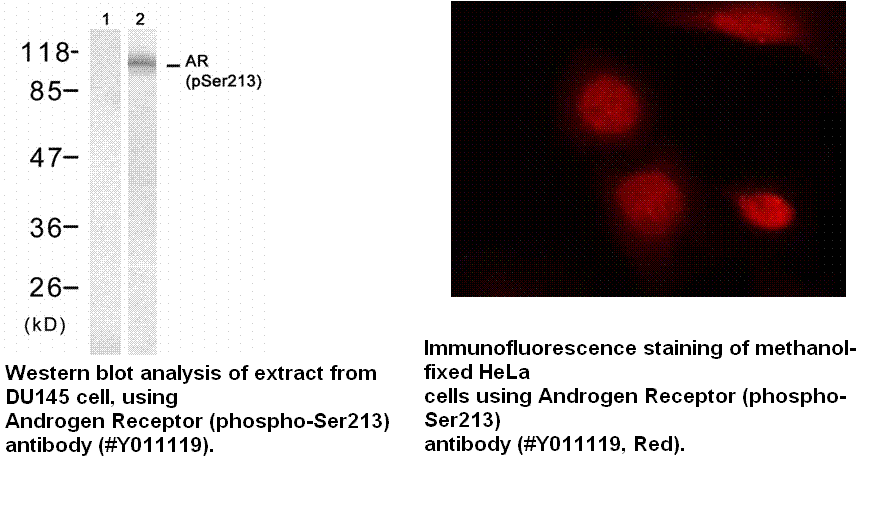 Anti-Androgen Receptor (Phospho-Ser213)