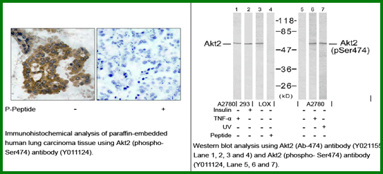 Anti-Akt2 (Phospho-Ser474)