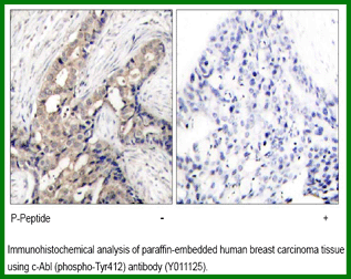 Anti-c-Abl (Phospho-Tyr412)