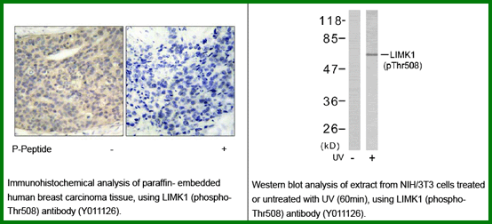 Anti-LIMK1 (Phospho-Thr508)