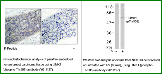 Anti-LIMK2 (Phospho-Thr505)