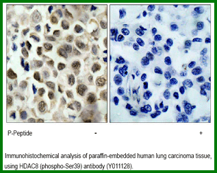 Anti-HDAC8 (Phospho-Ser39)