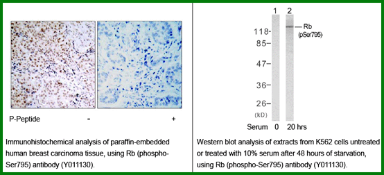 Anti-Rb (Phospho-Ser795)