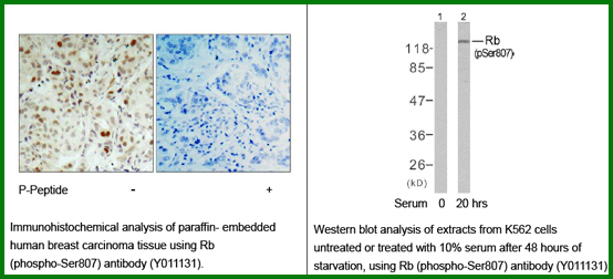 Anti-Rb (Phospho-Ser807)