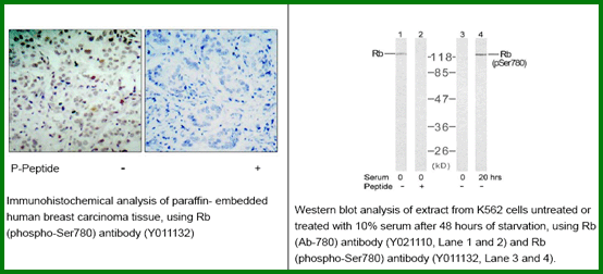 Anti-Rb (Phospho-Ser780)
