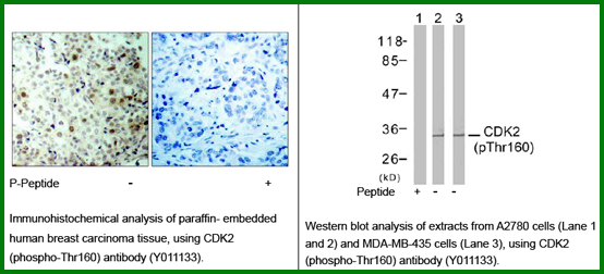 Anti-CDK2 (Phospho-Thr160)