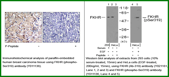 Anti-FKHR (Phospho-Ser319)