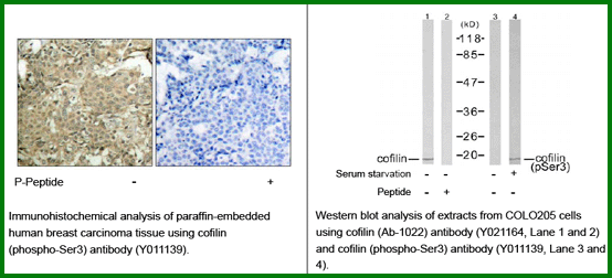 Anti-Cofilin (Phospho-Ser3)