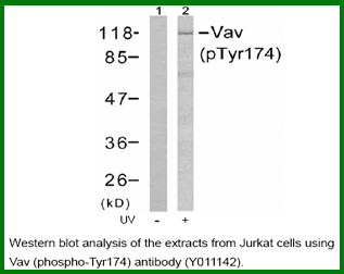 Anti-Vav (Phospho-Tyr174)
