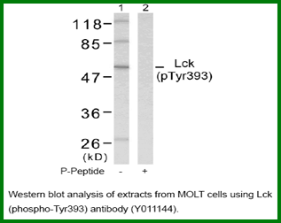 Anti-Lck (Phospho-Tyr393)
