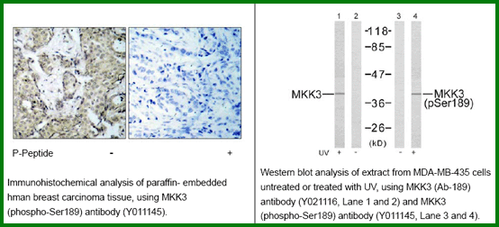Anti-MKK3 (Phospho-Ser189)