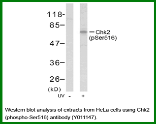 Anti-Chk2 (Phospho-Ser516)