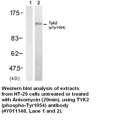 Anti-TYK2 (Phospho-Tyr1054)